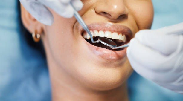 Best Emergency Wisdom Teeth Removal in North Shore, VA