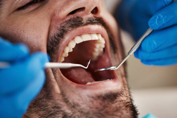 Best After-Hours Dental Trauma Care in North Shore, VA